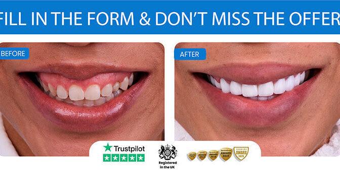 MDCT HOLLYWOOD SMILE MAKEOVER(Hollywood Smile with 20 guaranteed Zirconia Crowns) Consisting of 10-upper,10-lower VITA® Zirconium crown veneers, Digital Dentistry, Hotel Acoomodation in beatiful sea city of Istanbul Vacation
